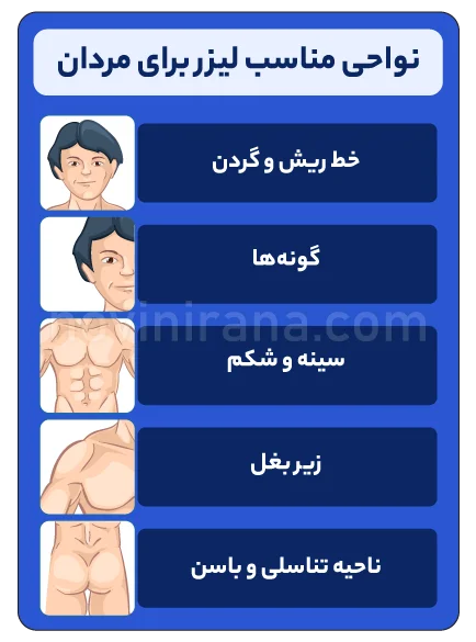 مناطق محبوب برای اعمال لیزر آقایان مشهد